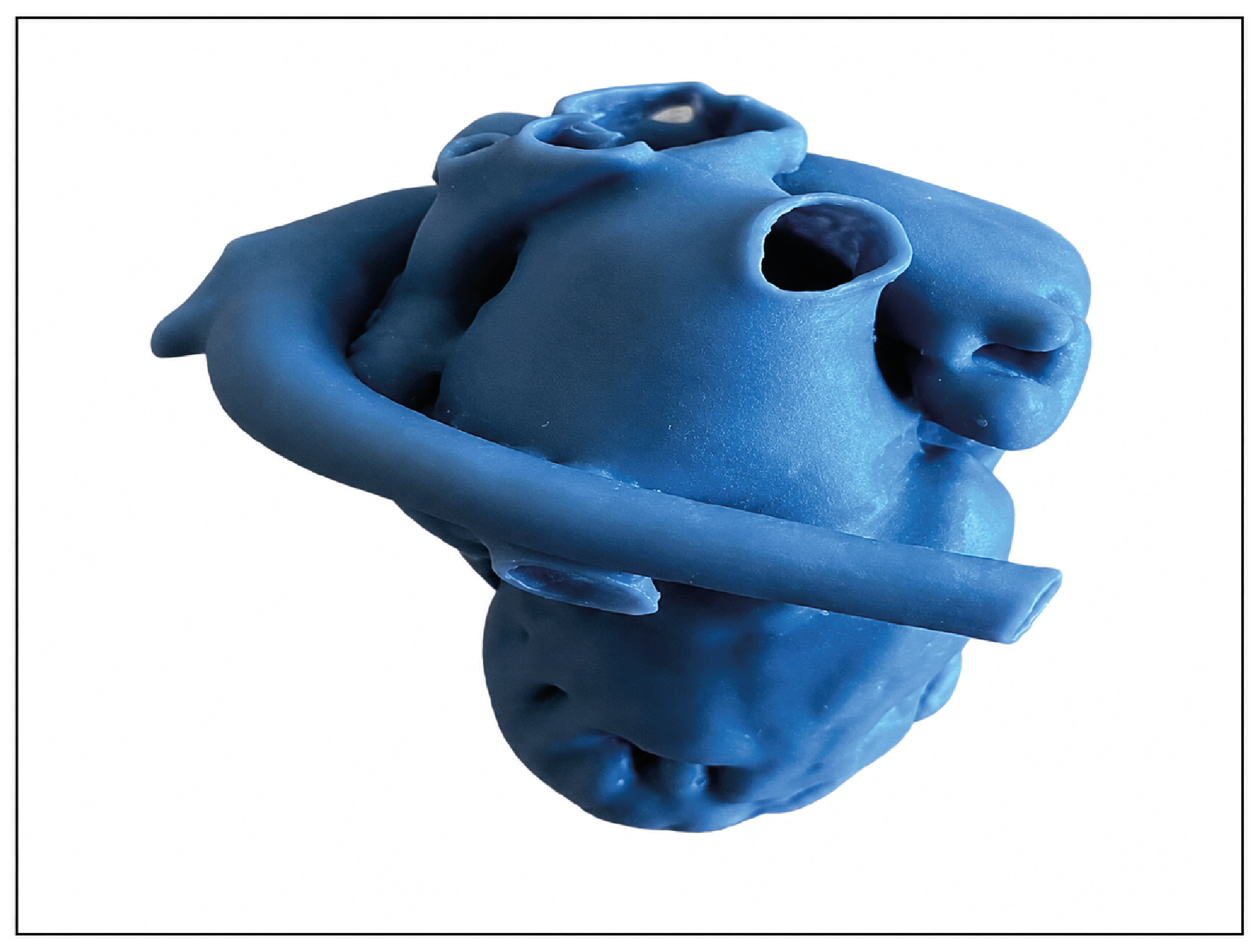 Figure 1. 3D heart model created from CT images