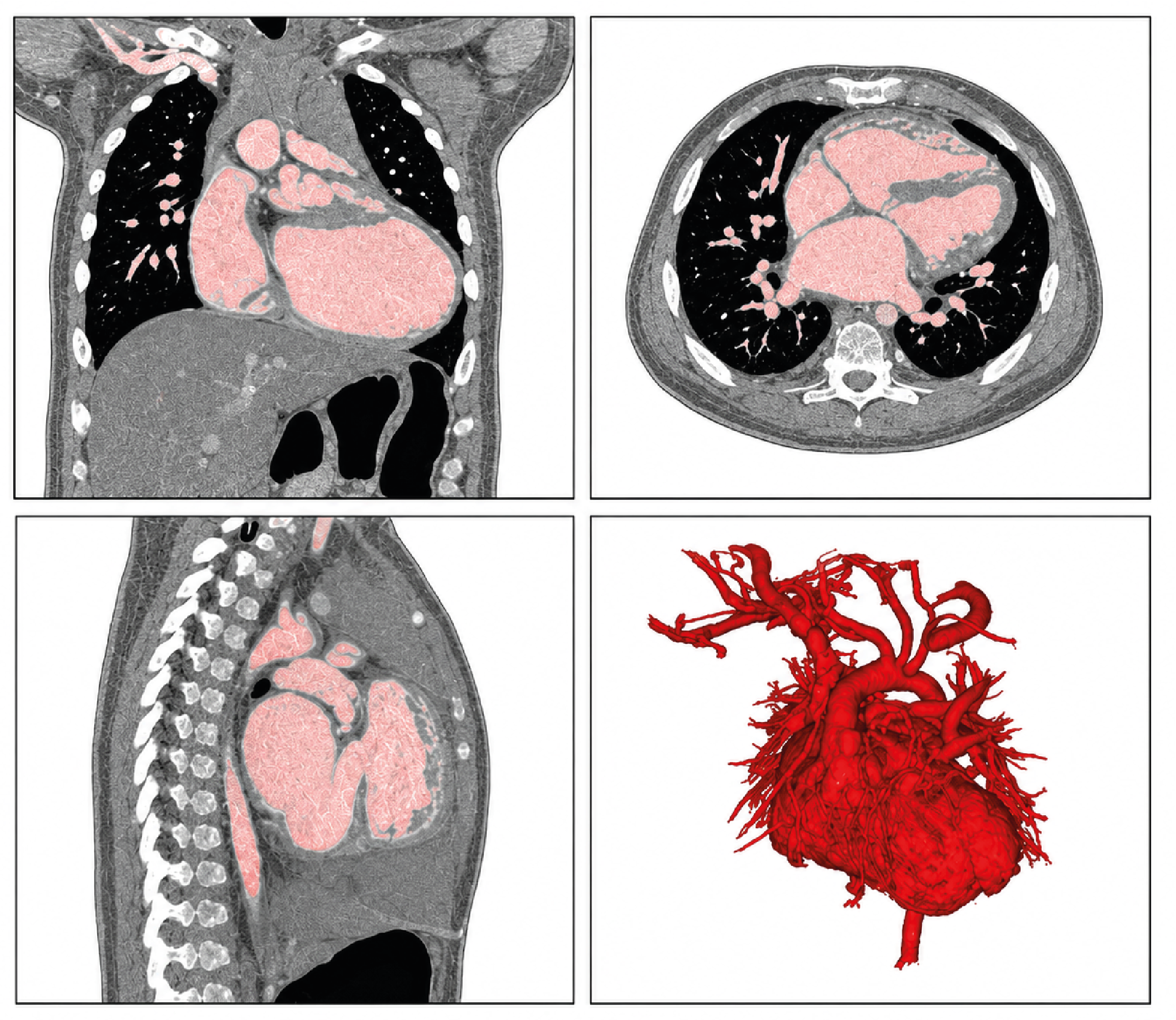Figure 3. View of the intracardiac structure
