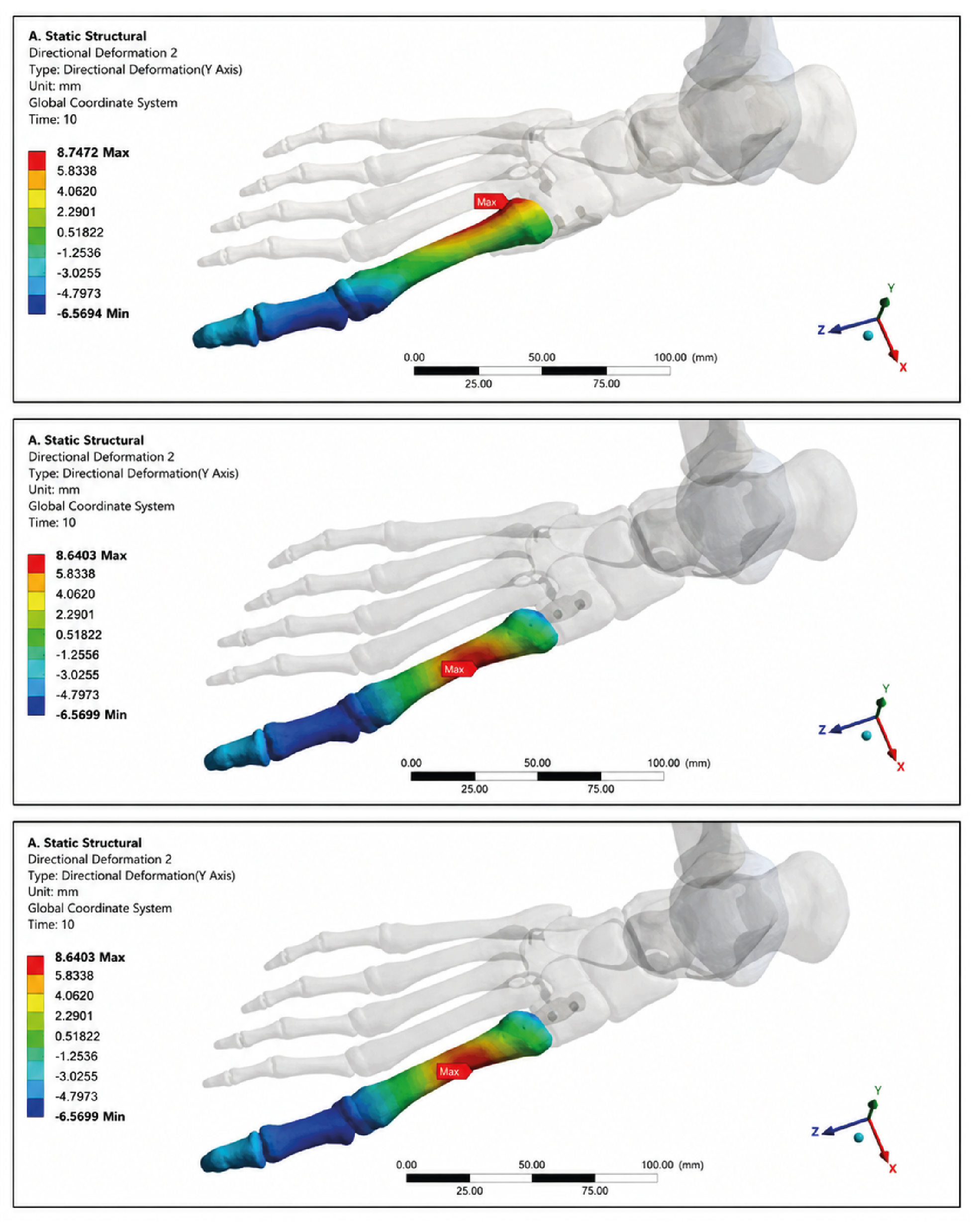 Figure 2. Displacements in Plates After Analyses, Medial (Upper), Dorsal (Middle), and Plantar (Bottom)