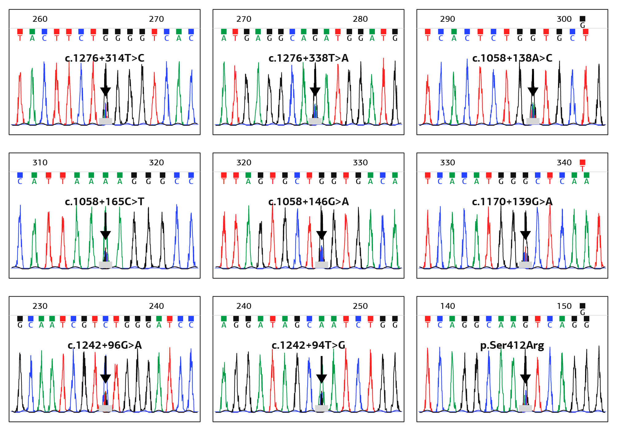 Figure 1. T2DM Group EPHX2, Results of Sanger DNA Sequencing and Detected Variants