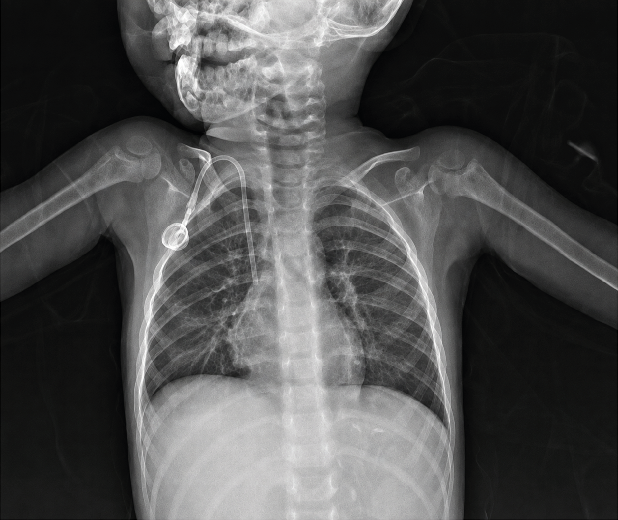 Figure 1. X-Ray was Normal