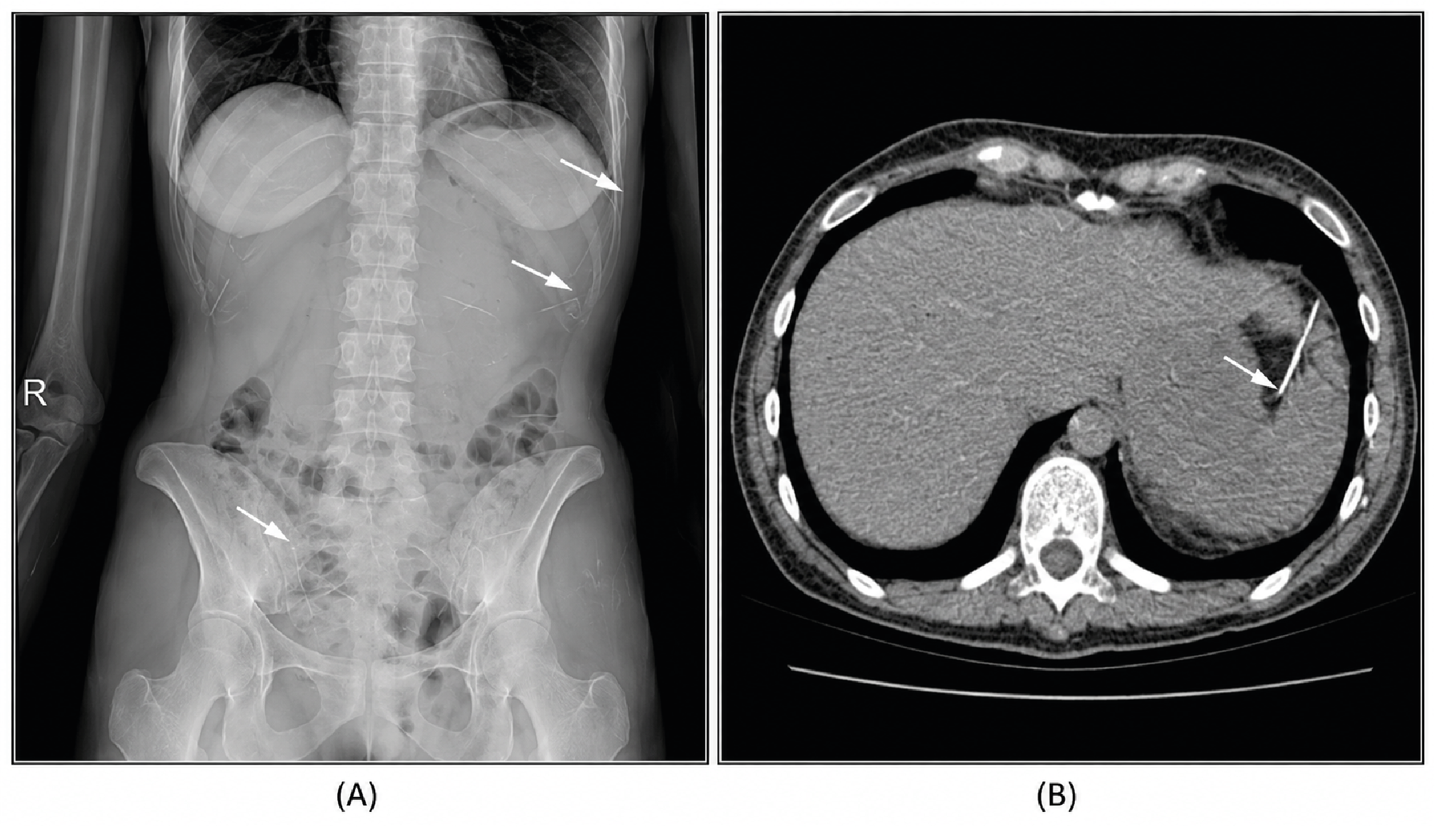 Figure 1. Case 1