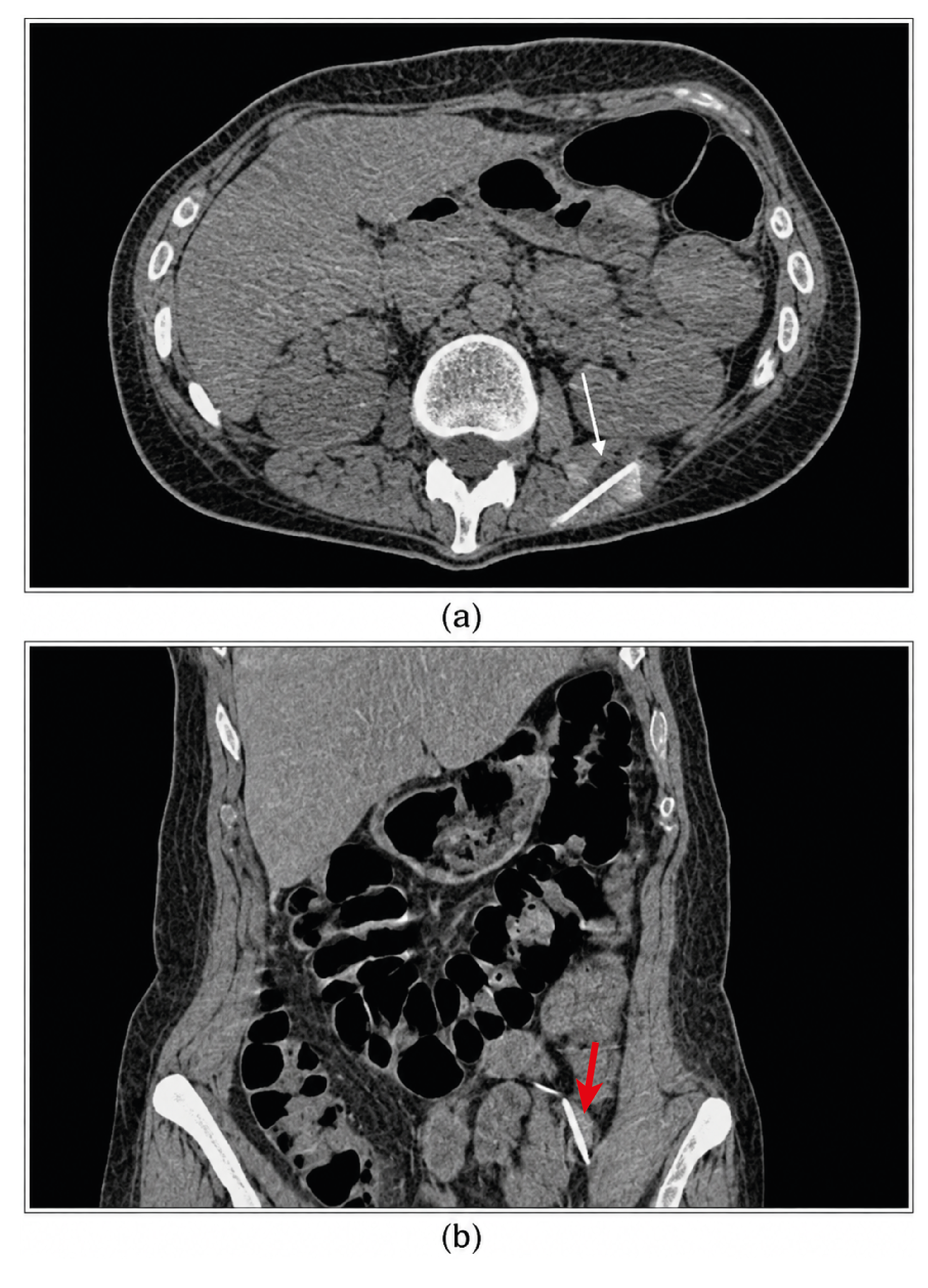 Figure 2. Case 1