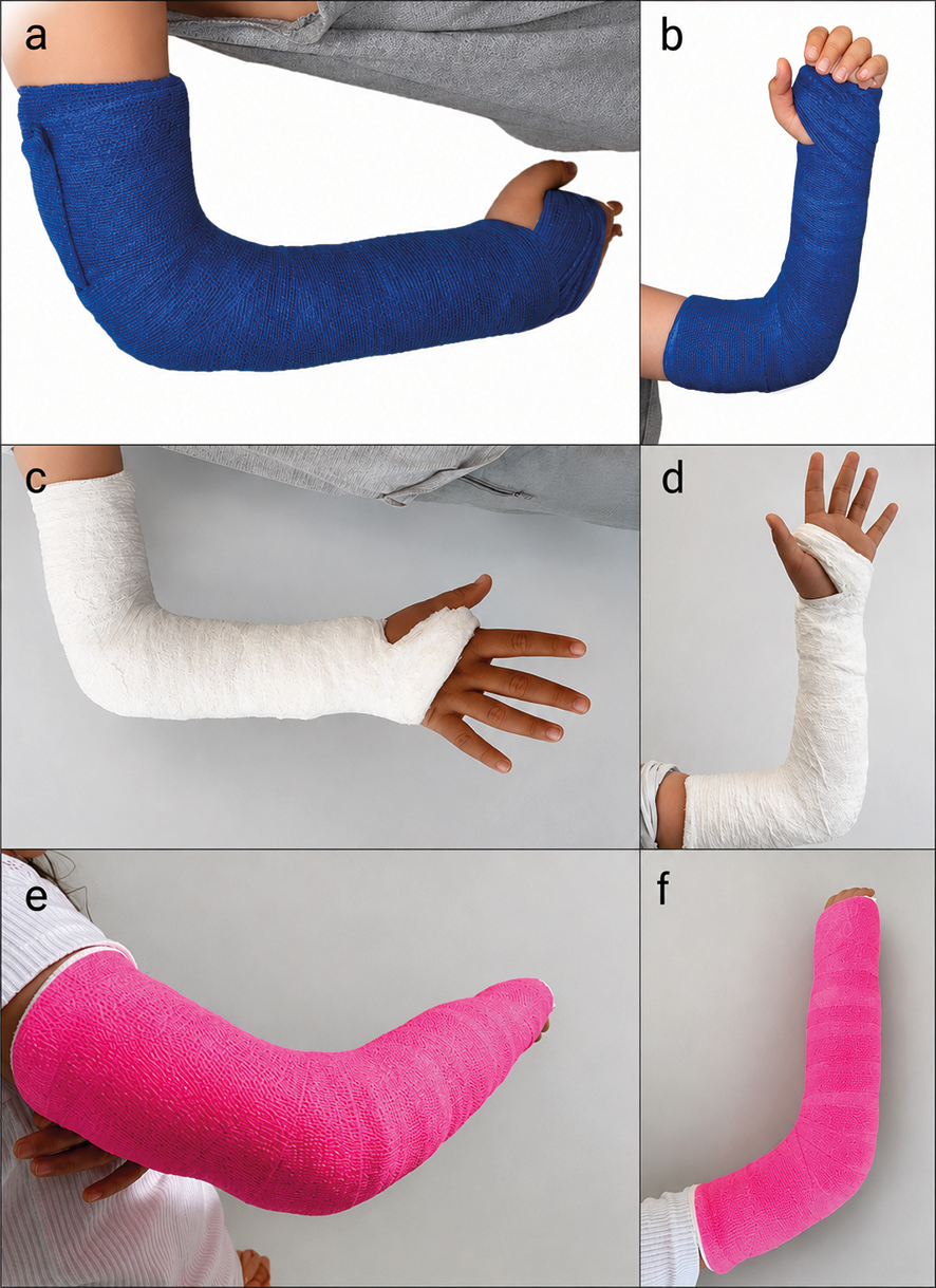 Figure 1. Representative long-arm cast colors used in the study