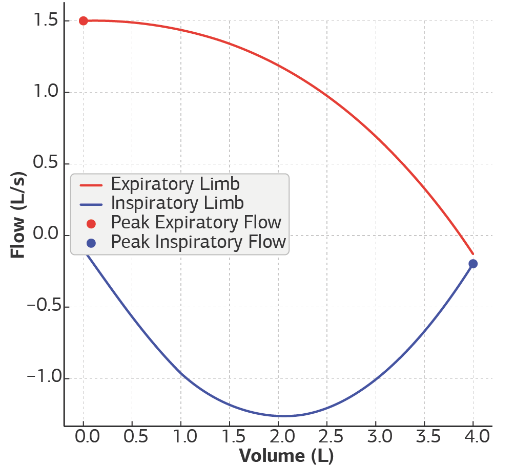Figure 2. Pulmonary function test flow-volume curve demonstrating inspiratory and expiratory flattening