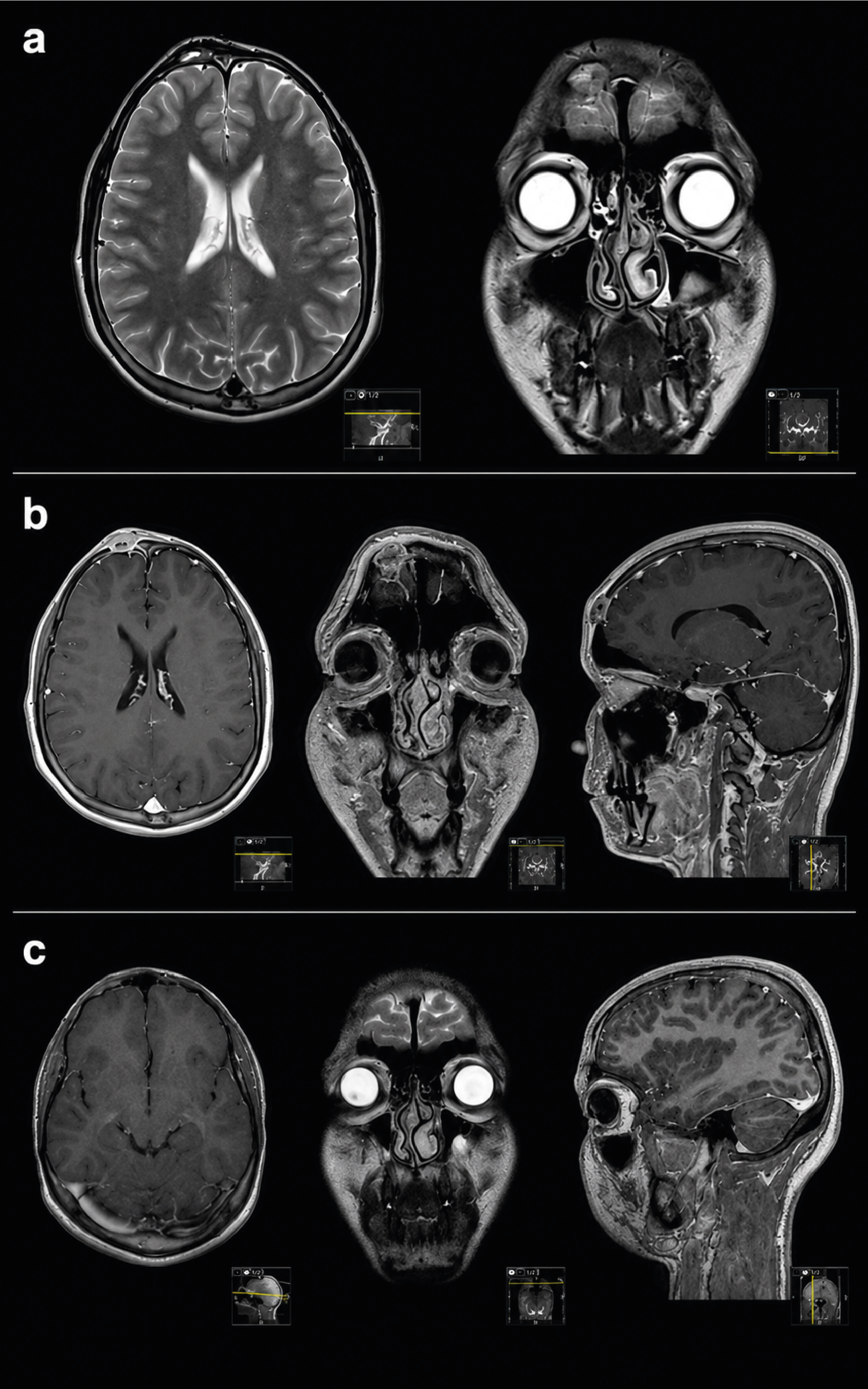 Figure 2. Pre-operational and Post-operational radiological assessments