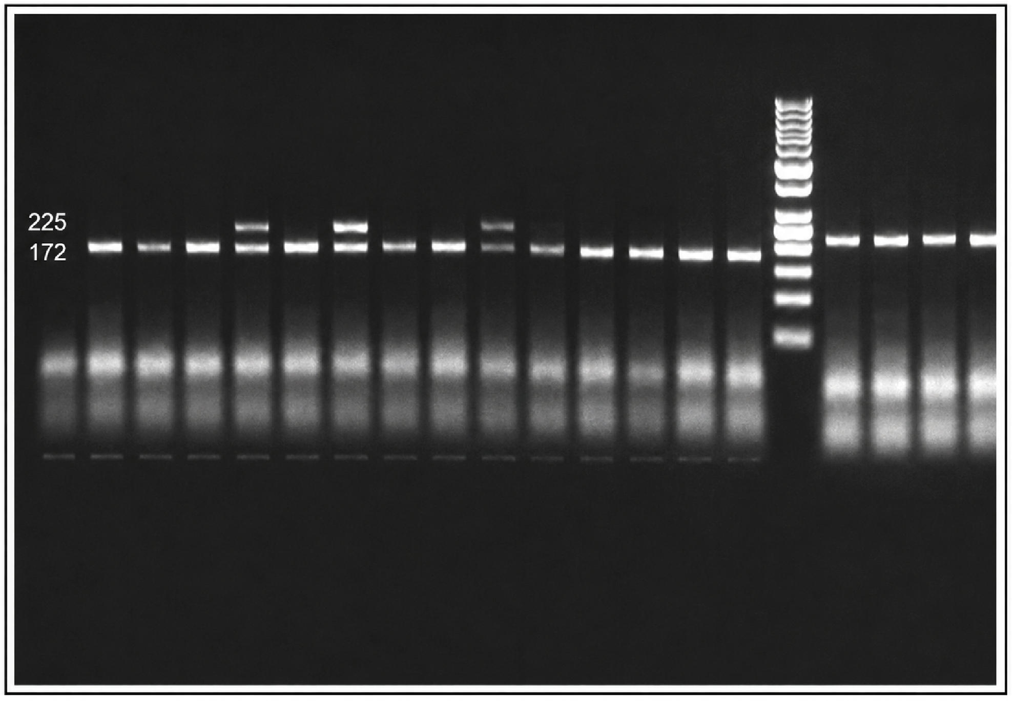 Figure 1. Enzymatic digestion of PD-1.5 (7209 C/T) gene polymorphism in different groups studied using a 50 bp size DNA ladder. T allele (225), C allele (172, 53). The 53 bp band appears faint on the gel