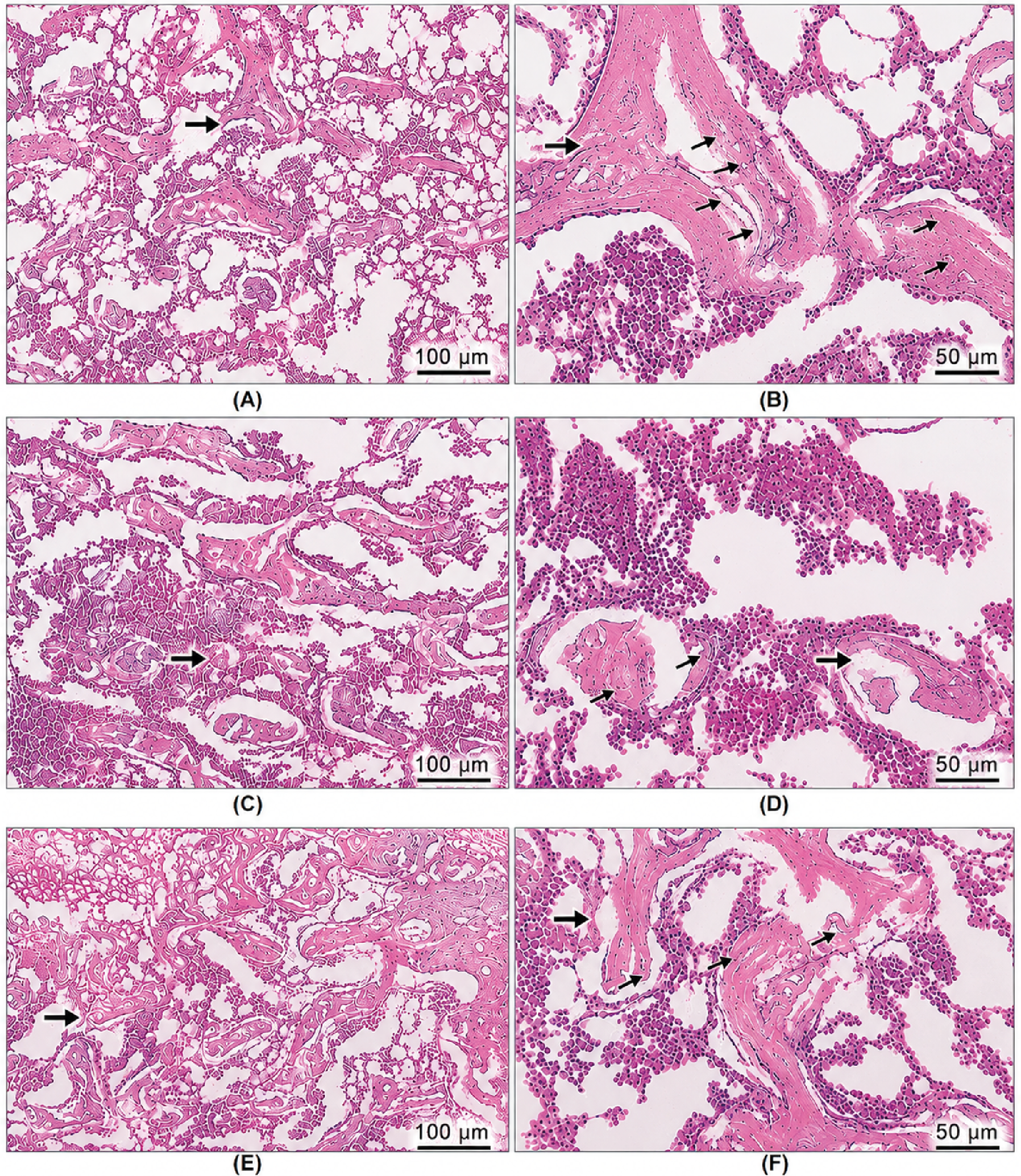 Figure 1. Microscopic pictures of HE stained sections of femur showing marked reduction in trabecular number & thickness with increased distance between trabeculae (thick arrows) (trabecular separation) in OVX group (C, D) when compared to control group (A, B). Numbers of osteocytes (thin arrows) located in lacunae in these trabeculae markedly decreased in OVX group when compared to control normal group. These criteria are reversed in treated groups OVX+Tempol (E, F). Magnifications X100 bar100 and X200 bar50.