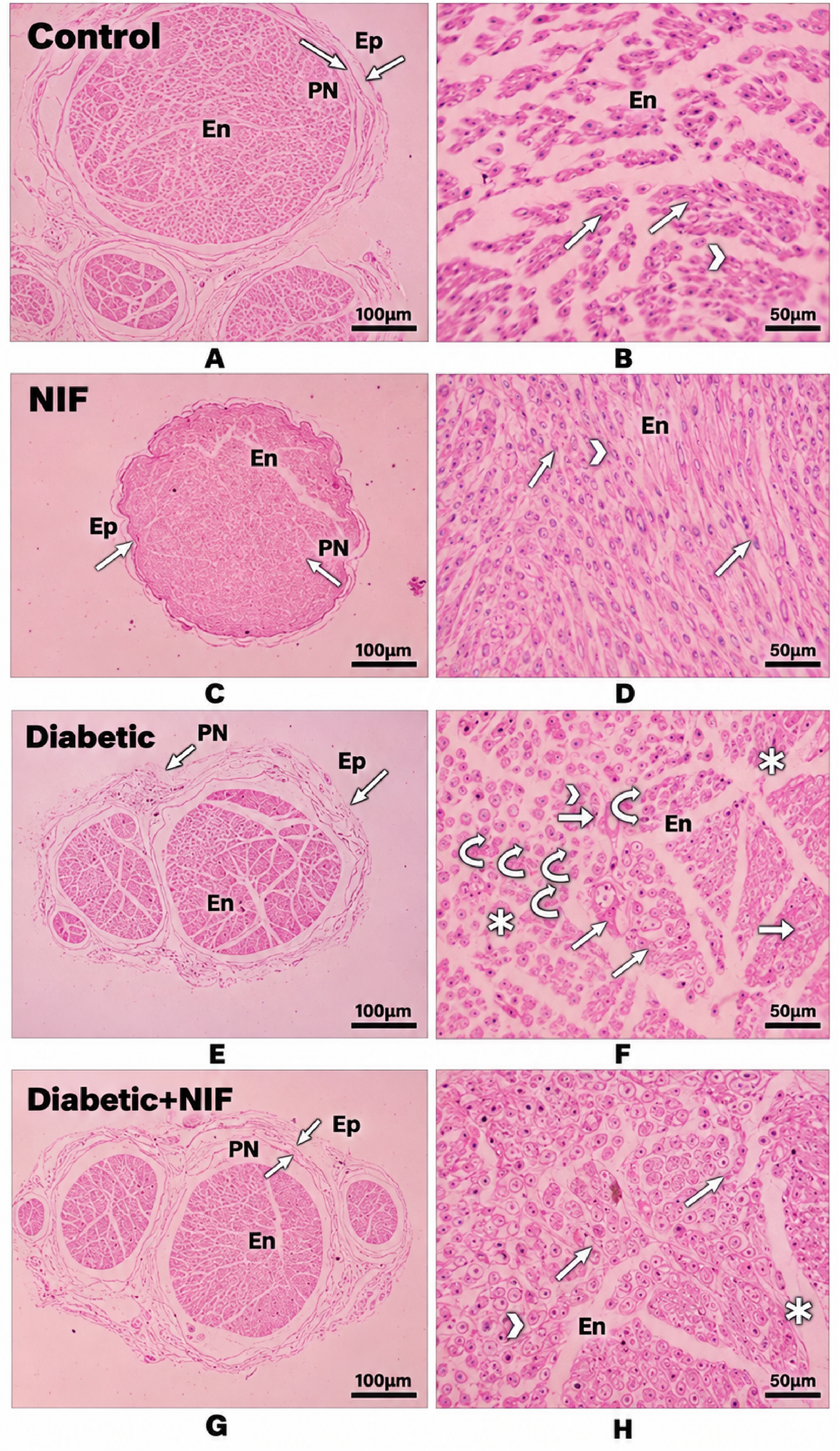 Figure 3. ELISA Measurements of Key Signaling, Inflammatory, and Apoptotic Proteins In Sciatic Nerve Supernatant: (A–B) JAK/STAT Pathway Proteins (p-JAK, p-STAT3); (C–F) Inflammatory Mediators (NF-κB, TNF-α, IL-6, IL-1β); (G–I) Apoptosis-Related Markers (caspase-3, Bax, Bcl-2)
